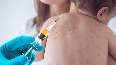 Measles epidemic increased because people were not vaccinated against measles